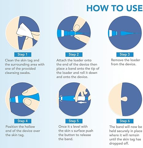 ✨ Acrochordon Skin Tag Remover Kit – 2-in-1 Fast & Painless Solution 🩹💖